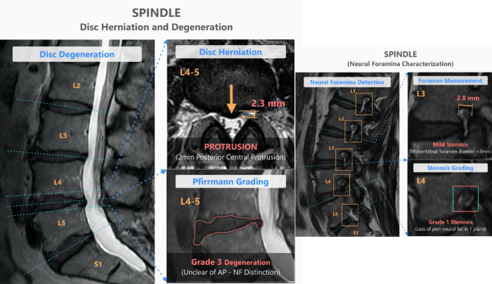 Spindle Report